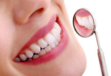 Cosmetic Orthodontics